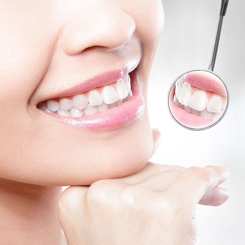 牙齒美白