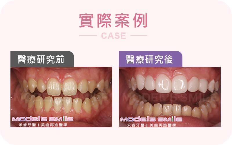 貼片打造專業形象 理專笑臉迎人不尷尬 貼片打造專業形象 理專笑臉迎人不尷尬